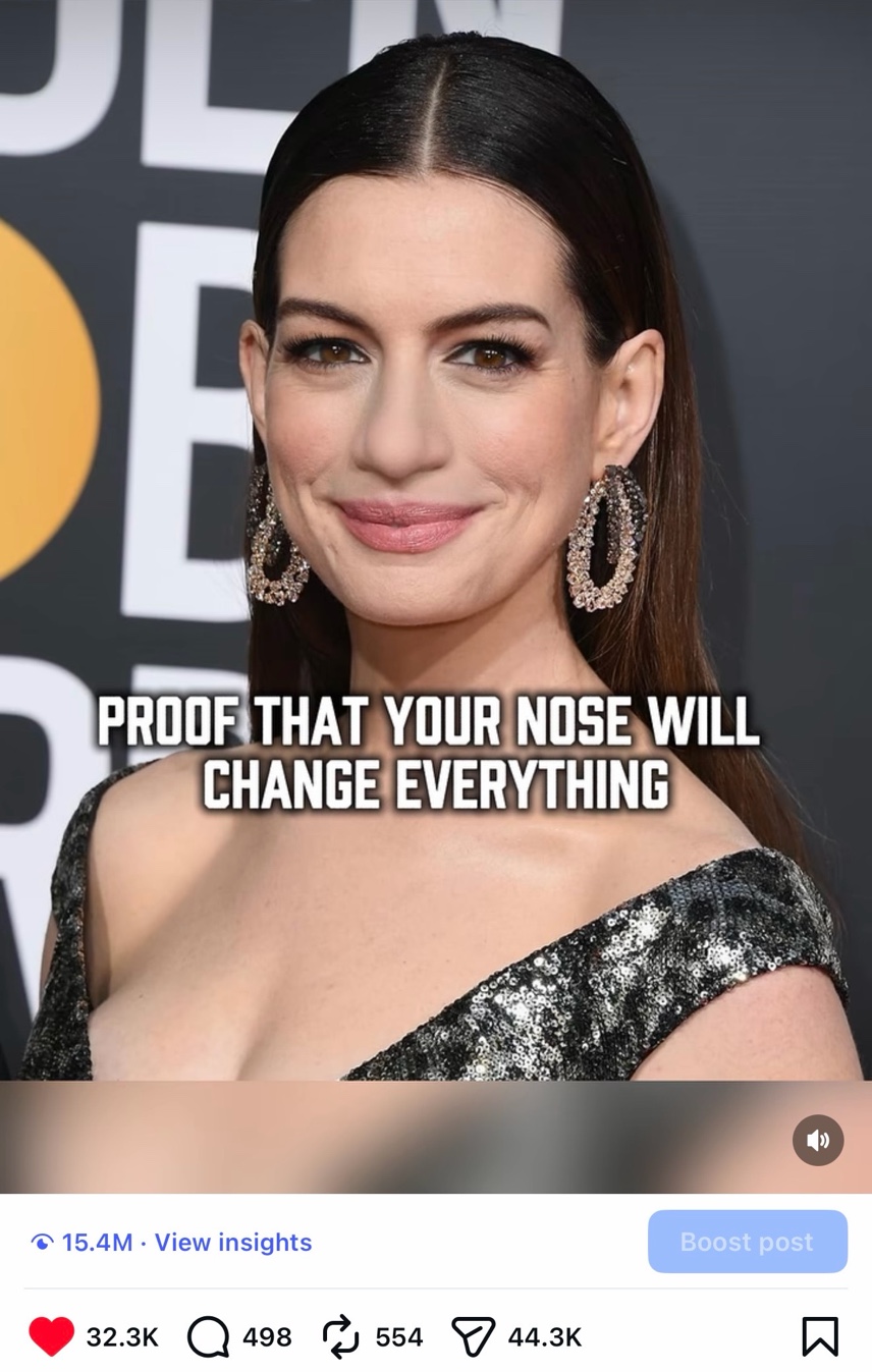 15.4M Views Rhinoplasty Reel